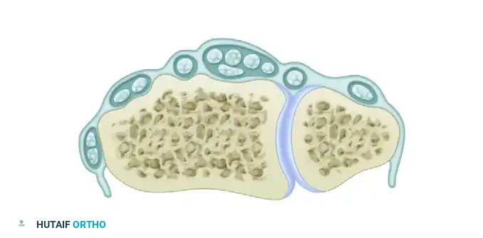Wrist Arthroscopy: Comprehensive Positioning and Portal Placement