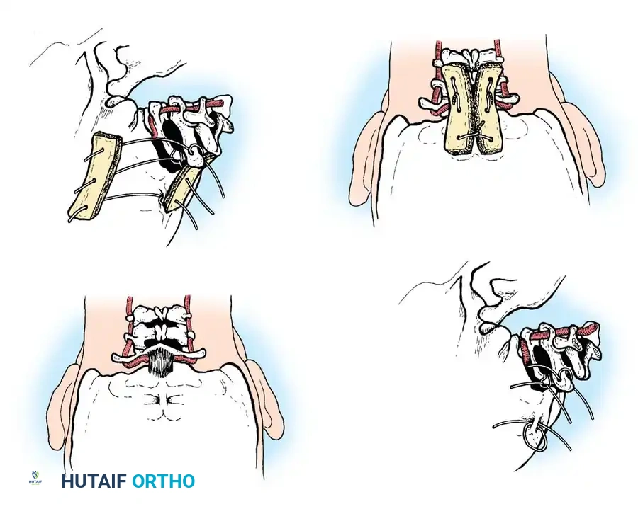 Hutaifortho's Orthopaedic Diagram