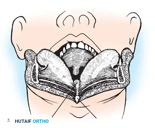 Hutaifortho's Orthopaedic Diagram