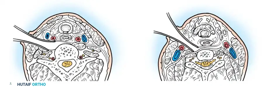 Hutaifortho's Orthopaedic Diagram
