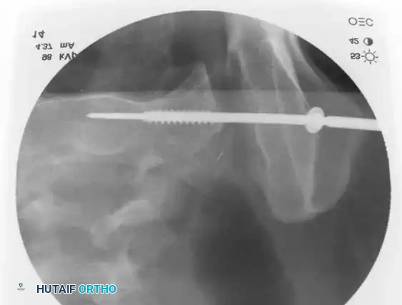 Hutaifortho's Orthopaedic Diagram