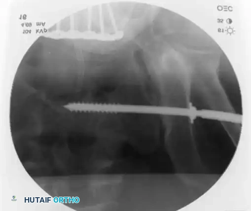 Hutaifortho's Orthopaedic Diagram
