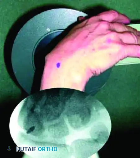 Fluoroscopic Targeting C