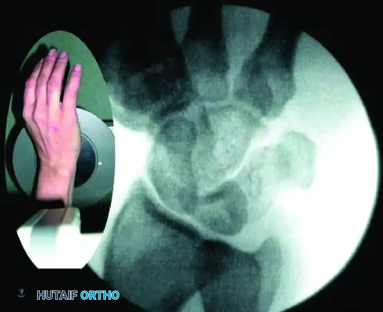 Fluoroscopic Targeting A