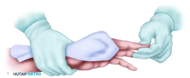 FIGURE 64-2 Assistant holds patient’s hand firm and motion less and exposes operative field for midlateral digital incision.
