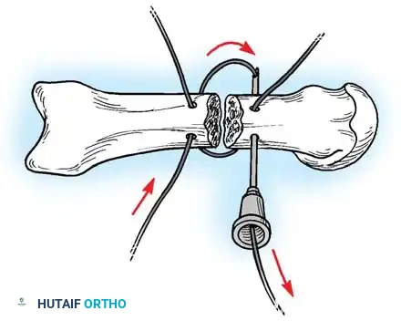 Hutaifortho's Orthopaedic Diagram