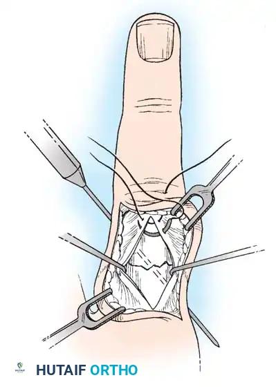 Hutaifortho's Orthopaedic Diagram
