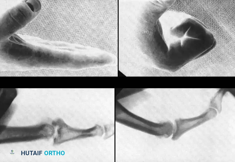 Hutaifortho's Orthopaedic Diagram