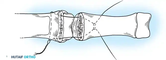 Hutaifortho's Orthopaedic Diagram