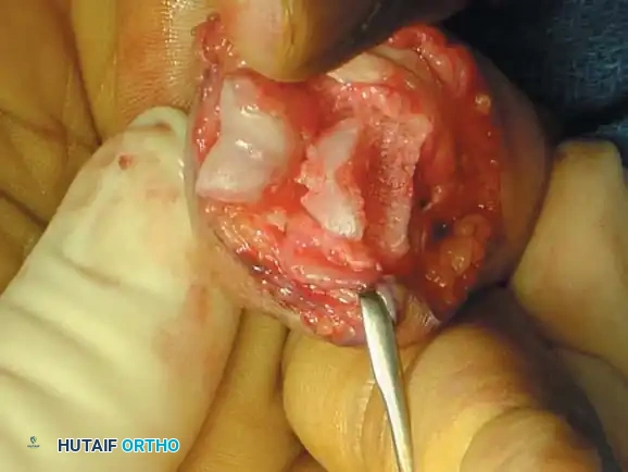 Hutaifortho's Orthopaedic Diagram