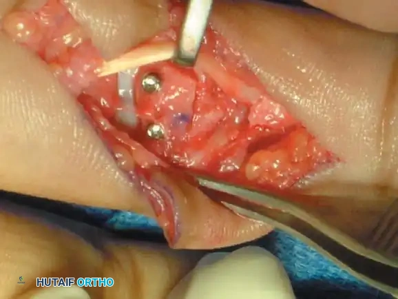 Hutaifortho's Orthopaedic Diagram