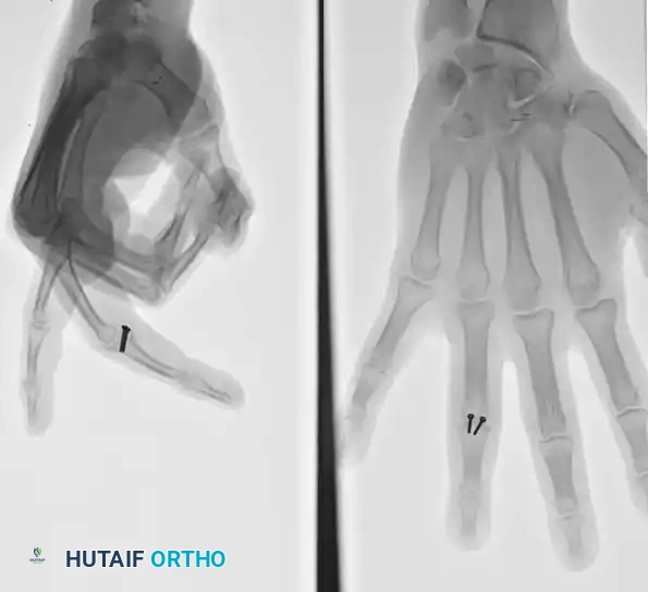 Hutaifortho's Orthopaedic Diagram