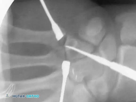 Hutaifortho's Orthopaedic Diagram