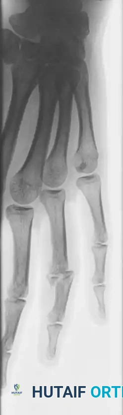 Hutaifortho's Orthopaedic Diagram