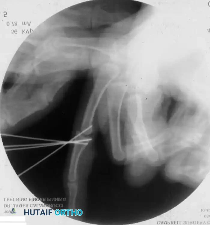Hutaifortho's Orthopaedic Diagram