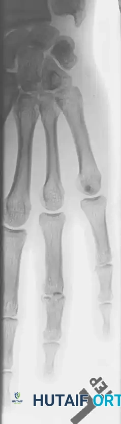 Hutaifortho's Orthopaedic Diagram