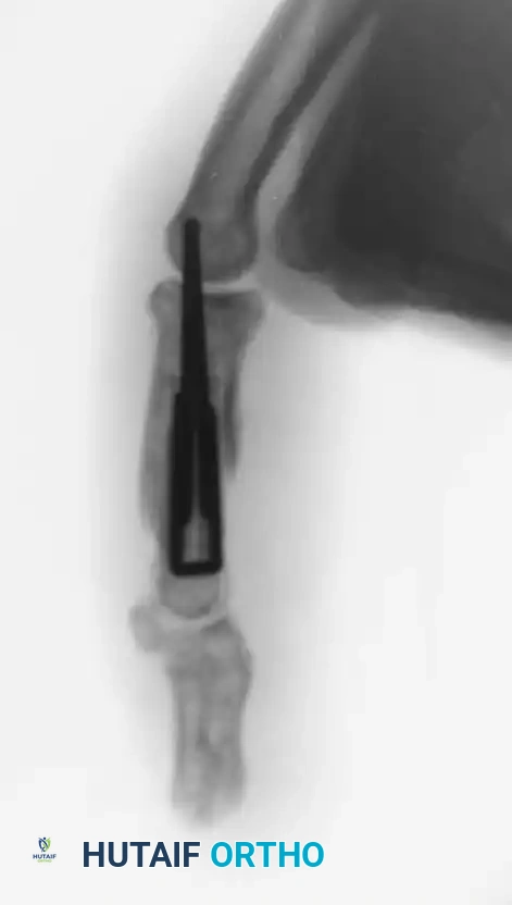 Hutaifortho's Orthopaedic Diagram