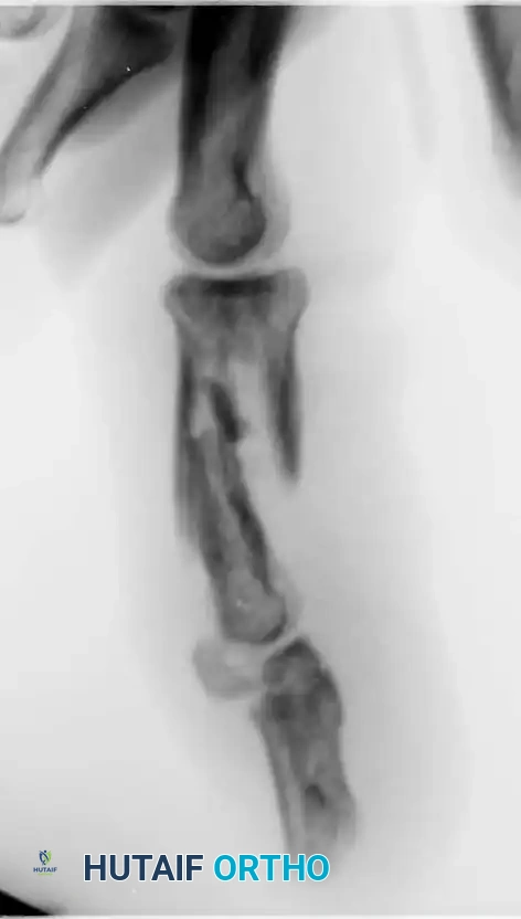 Hutaifortho's Orthopaedic Diagram