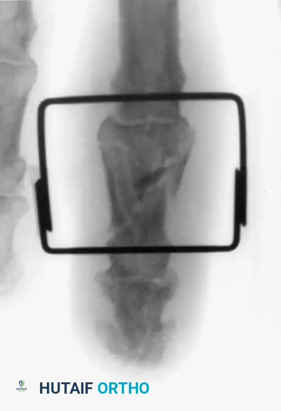Hutaifortho's Orthopaedic Diagram