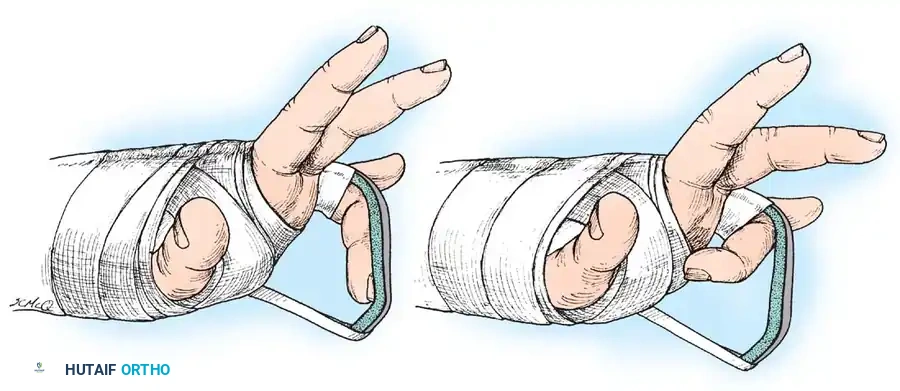 Hutaifortho's Orthopaedic Diagram