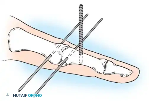 Hutaifortho's Orthopaedic Diagram
