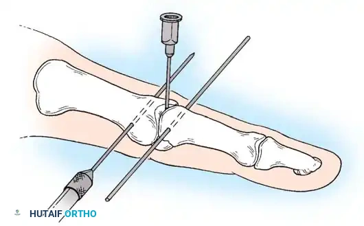 Hutaifortho's Orthopaedic Diagram