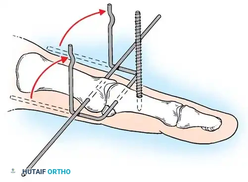 Hutaifortho's Orthopaedic Diagram