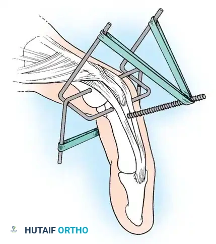 Hutaifortho's Orthopaedic Diagram