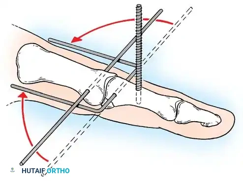 Hutaifortho's Orthopaedic Diagram