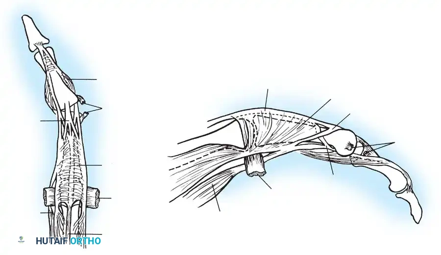 Hutaifortho's Orthopaedic Diagram