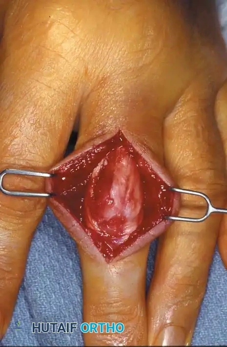 Hutaifortho's Orthopaedic Diagram