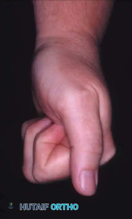 Hutaifortho's Orthopaedic Diagram