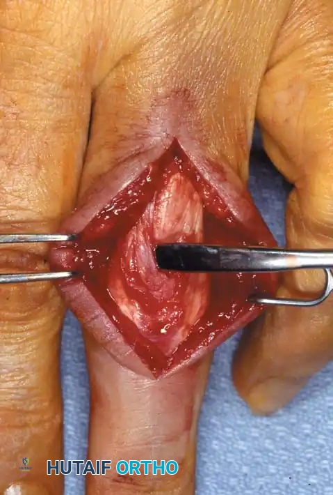 Hutaifortho's Orthopaedic Diagram