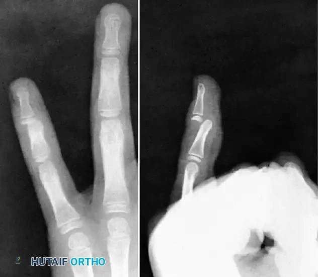 Hutaifortho's Orthopaedic Diagram