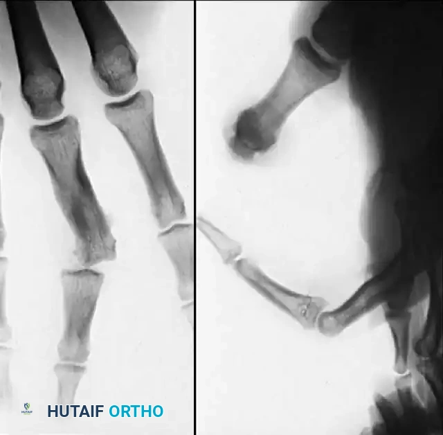 Hutaifortho's Orthopaedic Diagram