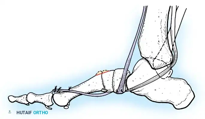 Hutaifortho's Orthopaedic Diagram