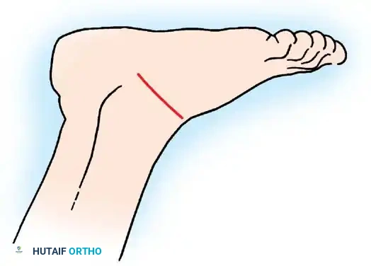 Hutaifortho's Orthopaedic Diagram