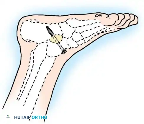 Hutaifortho's Orthopaedic Diagram