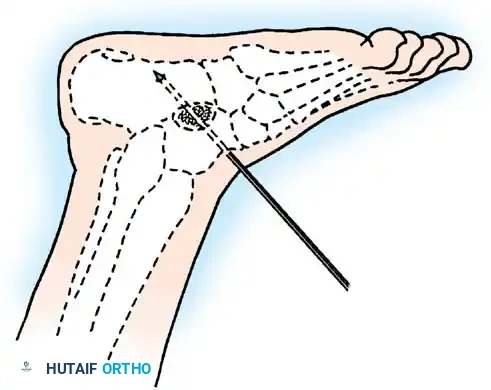 Hutaifortho's Orthopaedic Diagram