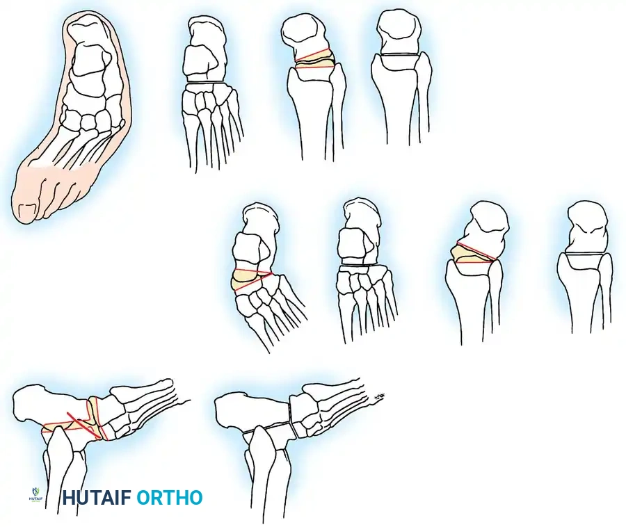 Hutaifortho's Orthopaedic Diagram