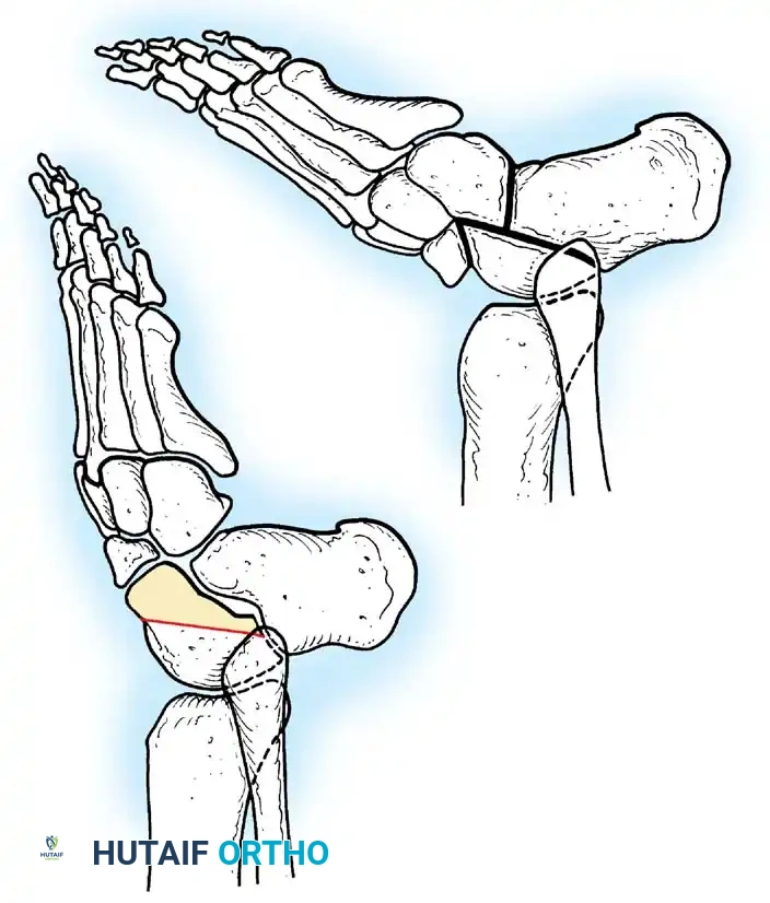 Hutaifortho's Orthopaedic Diagram
