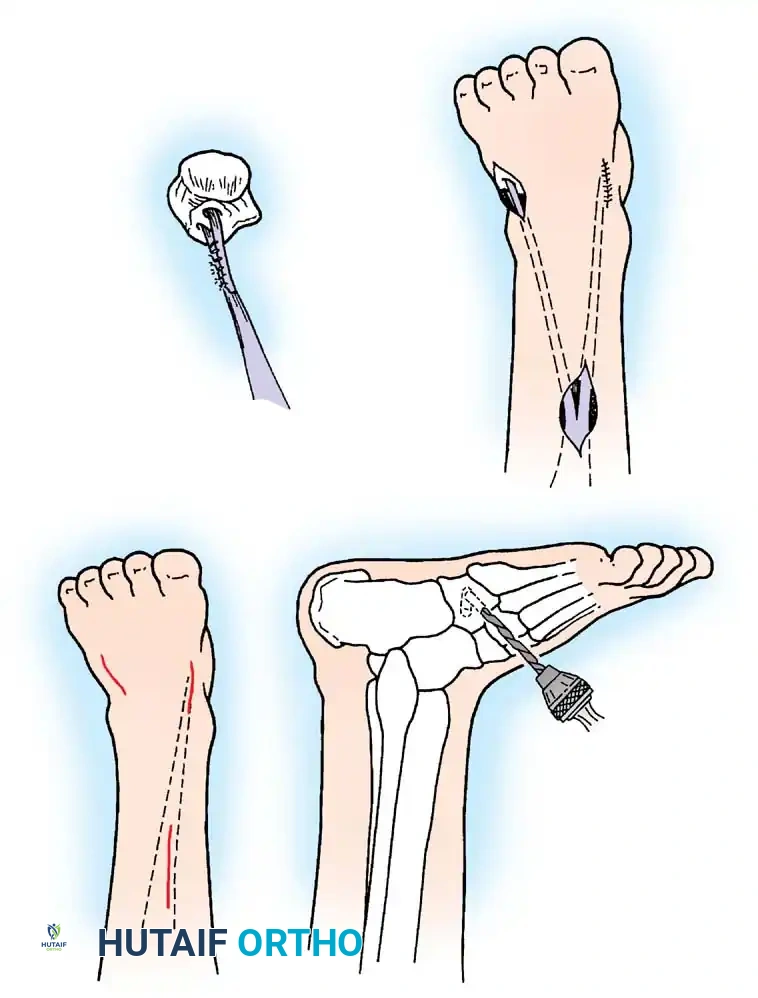 Hutaifortho's Orthopaedic Diagram
