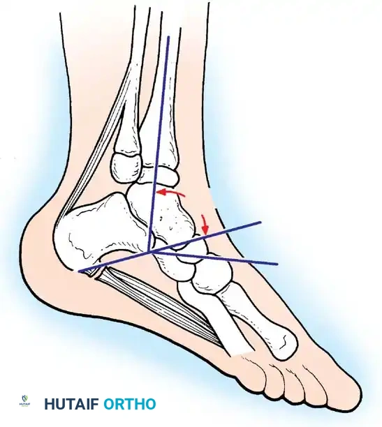 Hutaifortho's Orthopaedic Diagram