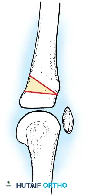 Hutaifortho's Orthopaedic Diagram