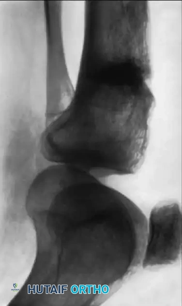 Hutaifortho's Orthopaedic Diagram