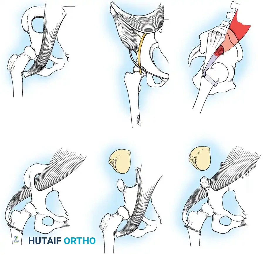 Hutaifortho's Orthopaedic Diagram