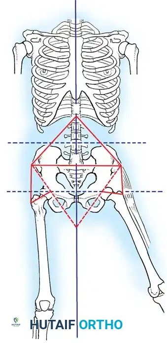 Hutaifortho's Orthopaedic Diagram