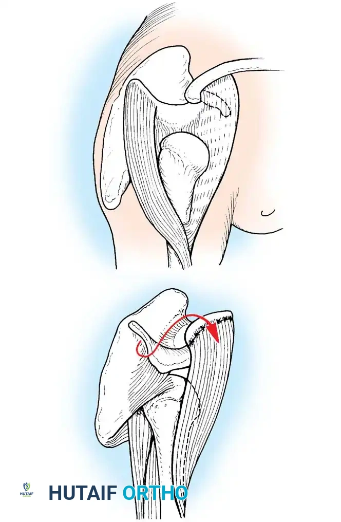 Hutaifortho's Orthopaedic Diagram
