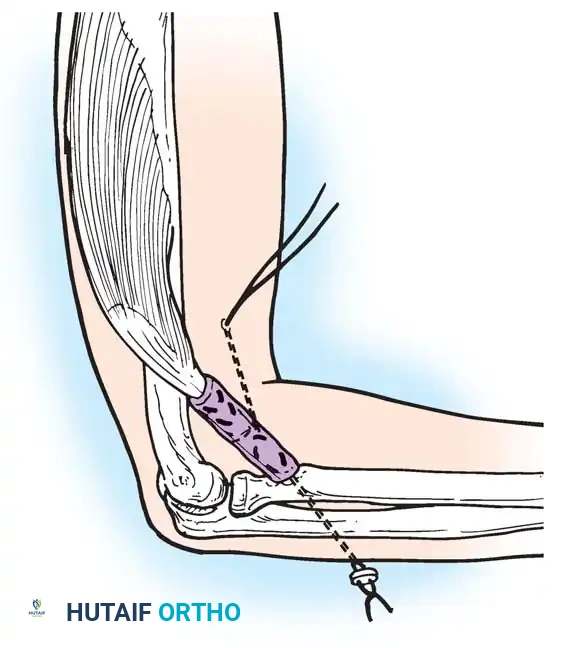 Hutaifortho's Orthopaedic Diagram