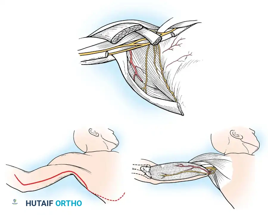 Hutaifortho's Orthopaedic Diagram